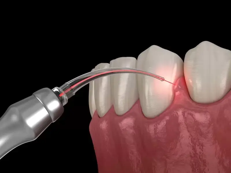 Periodontoloji Nedir?