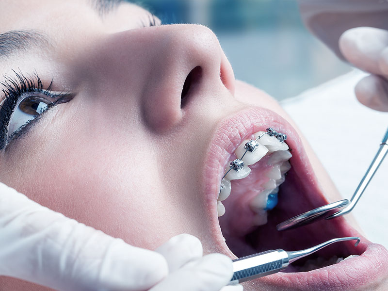 Nöbetçi Diş Kliniği Hangi Hizmetleri Sunar?